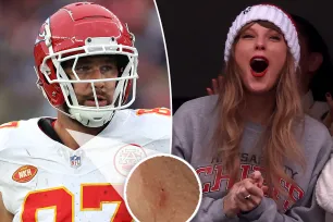 Taylor Swift fans go wild after noticing apparent ‘hickey’ on Travis Kelce’s neck