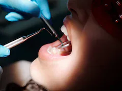 Woman Sues Dentist For Performing Over 30 Surgical Procedures In A Visit