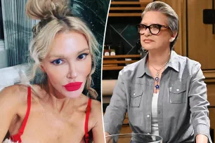 Brandi Glanville blames facial disfigurement on stress from Caroline Manzo scandal