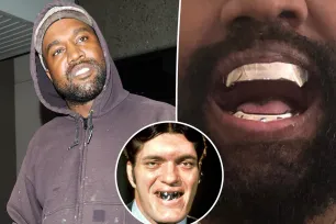 Kanye West has teeth removed and replaced with $850K titanium dentures modeled after James Bond spy