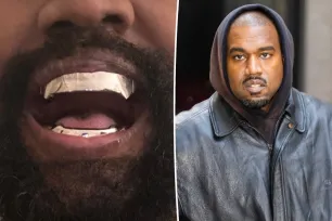 Kanye West’s $850K titanium dentures are ‘fixed and permanent,’ unlike grills or veneers: It’s ‘experimental dentistry’