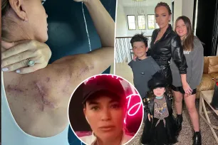 Teddi Mellencamp details candid conversations with her kids about her mental health during skin cancer journey