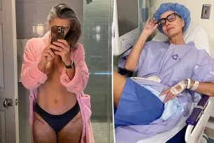 Paulina Porizkova shows off scars from hip replacement in bathrobe and little else