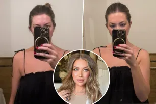 Stassi Schroeder shows before-and-after results of ‘Barbietox’ injections: ‘You’re welcome’