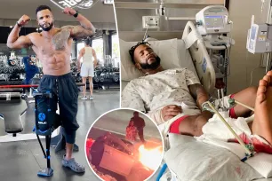 ‘Challenge’ star Nelson Thomas to have foot amputated exactly 1 year after DWI crash