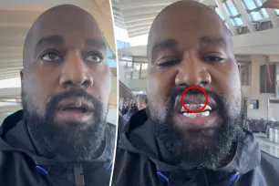 Fans question ‘protruding’ growth on Kanye West’s lip after $850K dental implant