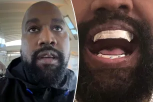 Kanye West’s lip ‘growth’ made more prominent by his $850K titanium dentures: celebrity dentist