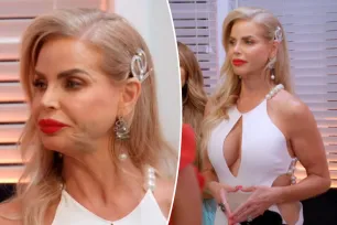 Alexia Nepola admits botched cosmetic procedure caused nasty bruise on face seen in ‘RHOM’ finale