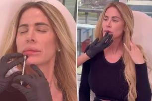 Kim Zolciak roasted for getting lip fillers, Botox amid alleged financial woes: ‘You are in debt up to your eyeballs’