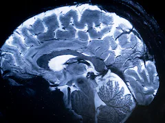 World's Most Powerful MRI Scans 1st Images Of Human Brain