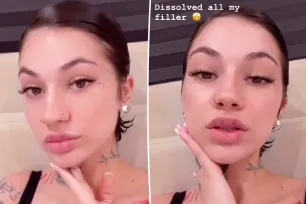 Bhad Bhabie dissolved her fillers, warns people to stop getting them: It makes you look ‘so much older’