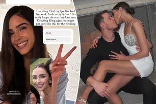 Olivia Culpo reveals she had lip filler dissolved ahead of Christian McCaffrey wedding