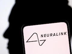 Elon Musk's Neuralink Says Issue In Brain Implant Fixed