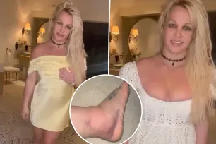 Britney Spears claims her massively swollen foot is ‘already better’ after it was ‘broken’ at Chateau Marmont