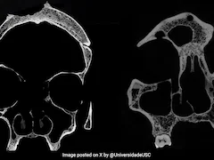 Cut Marks On 4,000-Year-Old Skulls Show Egyptians Tried To Treat Cancer