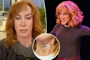 Kathy Griffin shares pic of neck bandaged up after 2nd vocal cord surgery