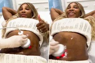 Serena Williams shares ‘amazing’ skin-tightening tummy procedure: ‘Confidence coming back’