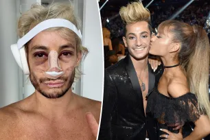 Ariana Grande reacts to brother Frankie’s bruised and bloodied selfie after nose job