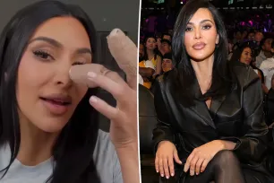 Kim Kardashian shows off gruesome finger injury that was ‘more painful than childbirth’