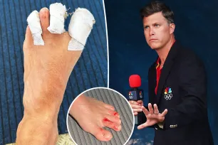 Colin Jost shares photos of bloody, bandaged toes while covering 2024 Olympics in Tahiti