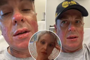 Kelly Osbourne’s boyfriend Sid Wilson says his ‘face is basically melted from nose down’ after explosion