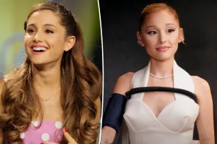 Ariana Grande sets the record straight about the cosmetic procedures she’s tried — and which she’s ‘open’ to